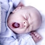 traitement du muguet chez bébé