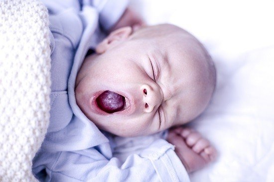 traitement du muguet chez bébé